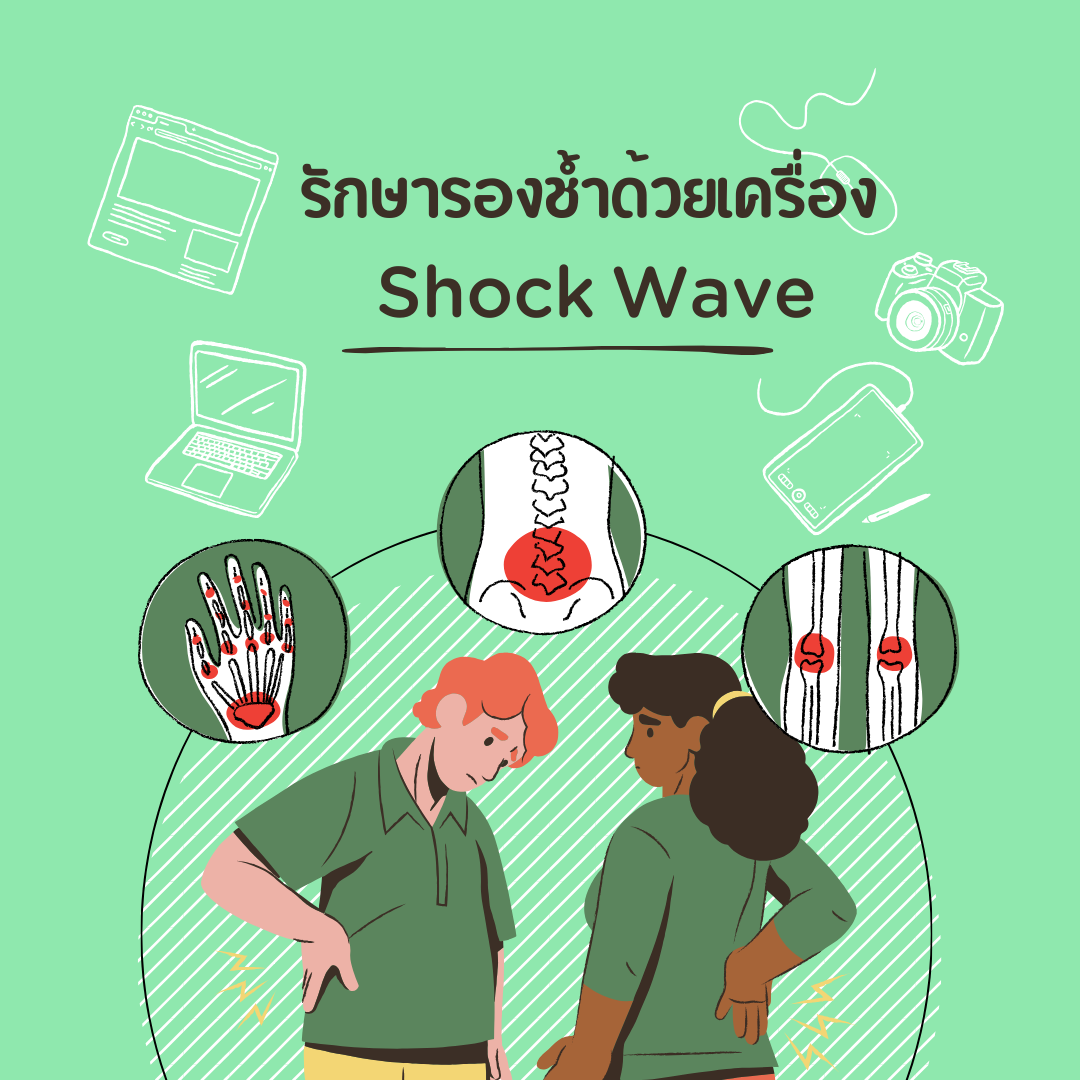 รักษารองช้ำด้วยเครื่อง Shock Wave